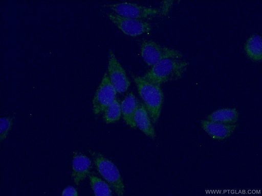 [14511-1-AP-20UL] Synaptotagmin-1 Polyclonal antibody