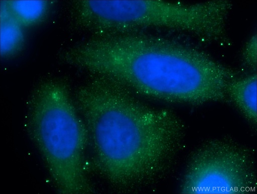[14514-1-AP-150UL] CREB3L2 Polyclonal antibody