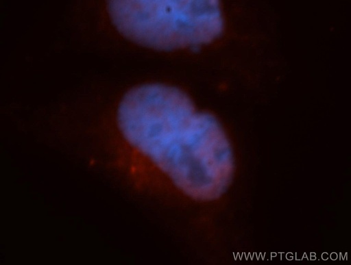 [14516-1-AP-20UL] CARD8 Polyclonal antibody