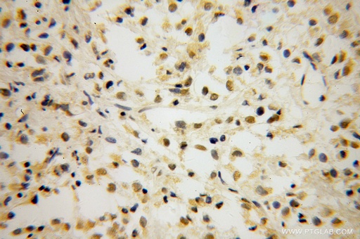 [14519-1-AP-20UL] TCF7L1 Polyclonal antibody