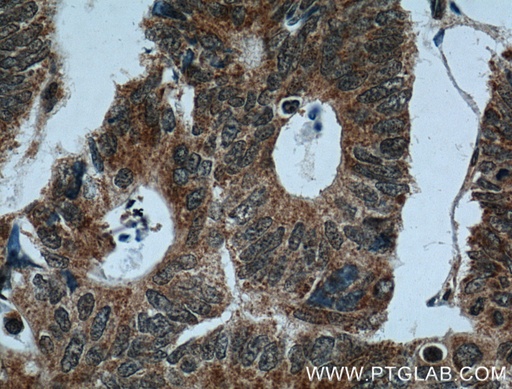 [14521-1-AP-150UL] CRMP2 Polyclonal antibody