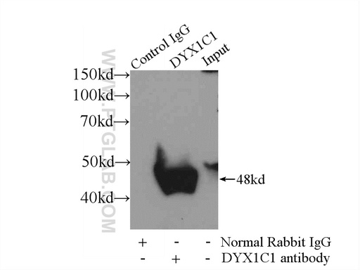 [14522-1-AP-150UL] DYX1C1 Polyclonal antibody