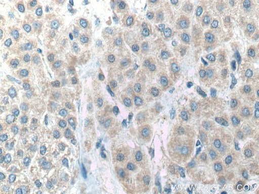 [14527-1-AP-20UL] ACADVL Polyclonal antibody