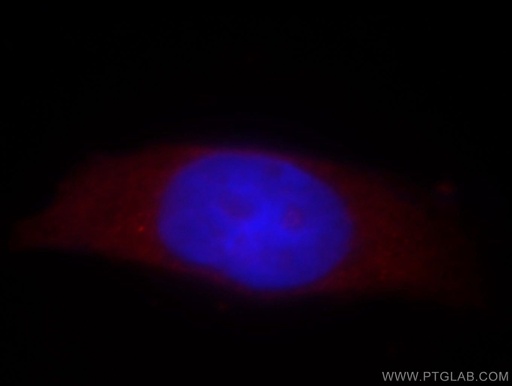 [14531-1-AP-150UL] TSSC4 Polyclonal antibody