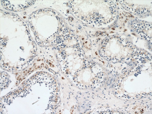 [14535-1-AP-150UL] GSTK1 Polyclonal antibody