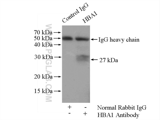 [14537-1-AP-150UL] Hemoglobin Alpha Polyclonal antibody