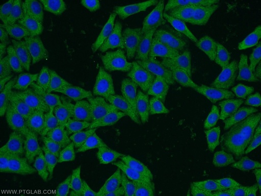 [14538-1-AP-20UL] TCP10 Polyclonal antibody