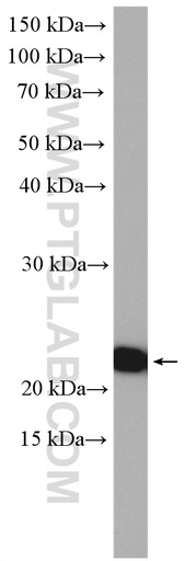[14543-1-AP-150UL] LZIC Polyclonal antibody