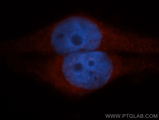 [14545-1-AP-150UL] CLIC1 Polyclonal antibody