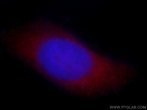 [14548-1-AP-150UL] ARFIP2 Polyclonal antibody