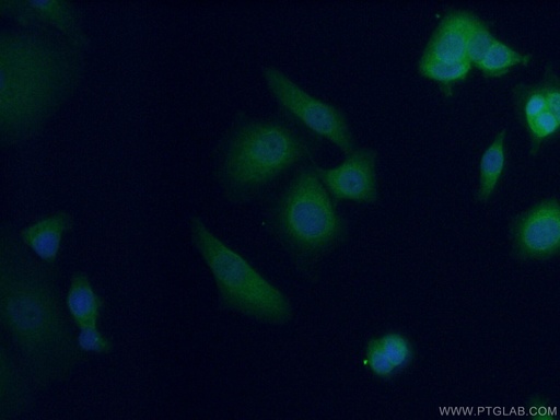 [14550-1-AP-20UL] AFP Polyclonal antibody