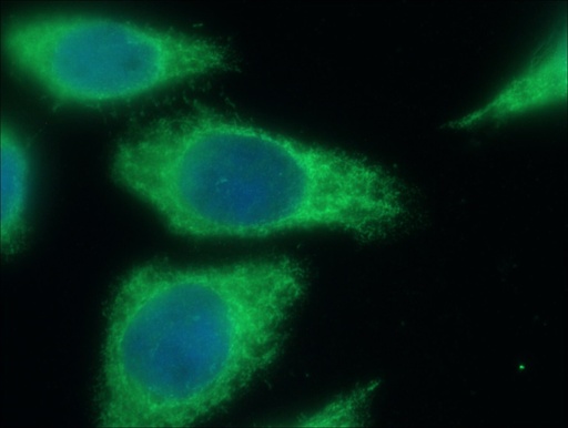 [14552-1-AP-20UL] MT1-MMP Polyclonal antibody