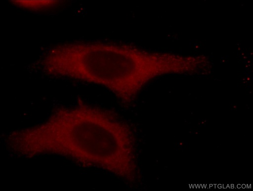 [14555-1-AP-150UL] Alpha Tubulin Polyclonal antibody