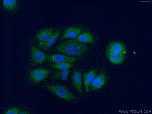 [14560-1-AP-20UL] DHRS9 Polyclonal antibody