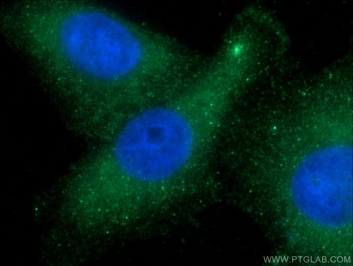 [14563-1-AP-150UL] CDR2L Polyclonal antibody