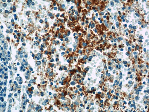 [14564-1-AP-150UL] GP9 Polyclonal antibody