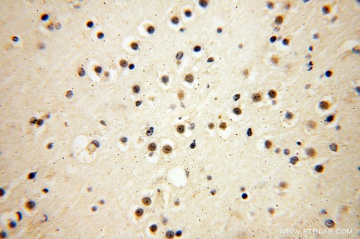 [14574-1-AP-150UL] DEDD2 Polyclonal antibody