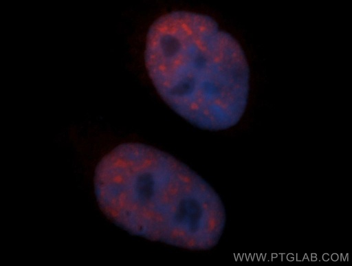 [14577-1-AP-20UL] SF3B3 Polyclonal antibody