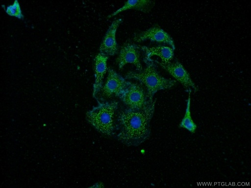 [14578-1-AP-20UL] Pikachurin Polyclonal antibody
