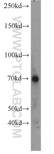 [14580-1-AP-150UL] Perforin Polyclonal antibody