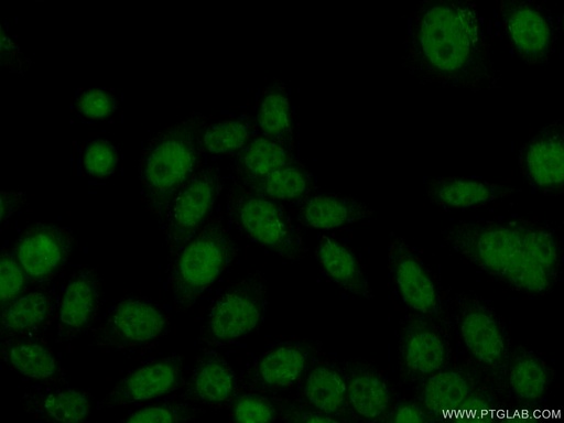 [14582-1-AP-20UL] HMG20B Polyclonal antibody