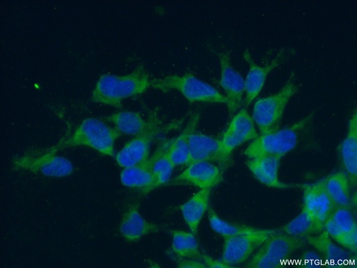 [14583-1-AP-150UL] RPL7 Polyclonal antibody