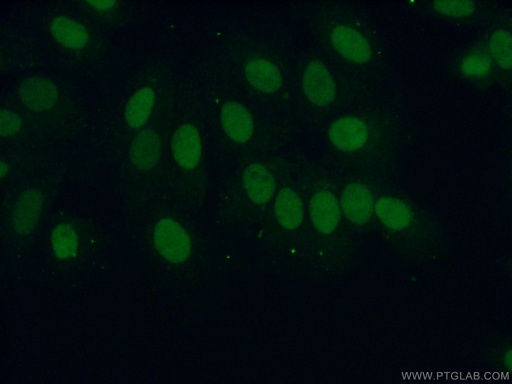 [14586-1-AP-20UL] ERCC1 Polyclonal antibody