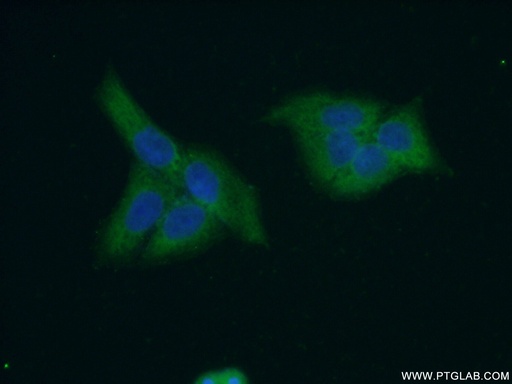 [14587-1-AP-150UL] CES3 Polyclonal antibody