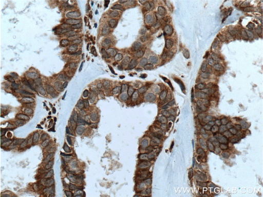 [14589-1-AP-150UL] IKIP Polyclonal antibody