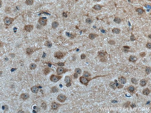 [14590-1-AP-150UL] FBXO2 Polyclonal antibody