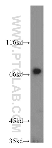 [14594-1-AP-150UL] RAB11FIP5 Polyclonal antibody