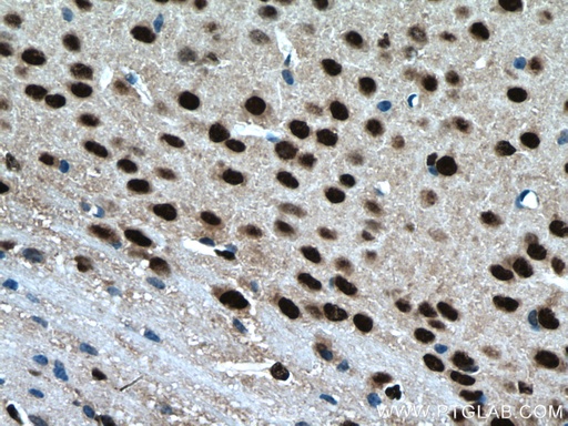 [14596-1-AP-150UL] BRN2 Polyclonal antibody