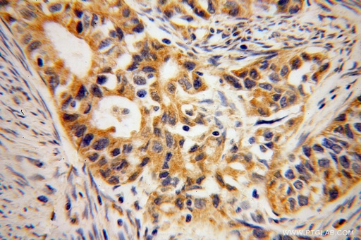 [14601-1-AP-150UL] B3GALTL Polyclonal antibody