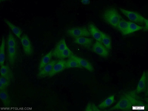 [14602-1-AP-150UL] MAGEA6 Polyclonal antibody