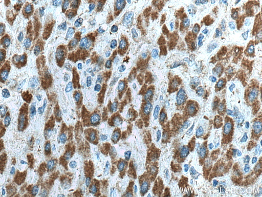 [14603-1-AP-20UL] HIBCH Polyclonal antibody