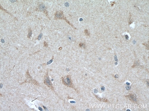 [14609-1-AP-20UL] SMPD1,ASM Polyclonal antibody