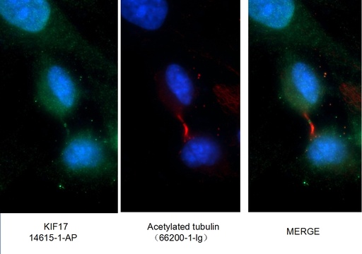 [14615-1-AP-150UL] KIF17 Polyclonal antibody