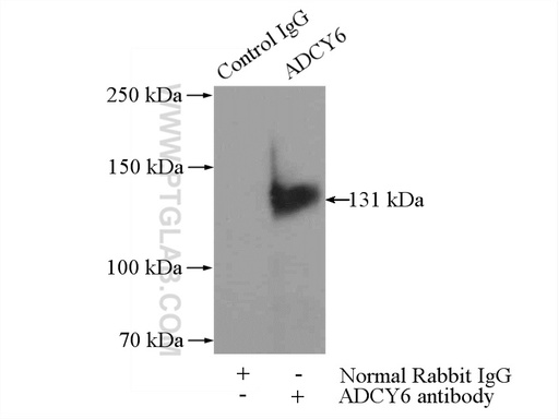[14616-1-AP-150UL] ADCY6 Polyclonal antibody