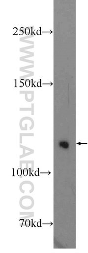 [14620-1-AP-150UL] TUBGCP5 Polyclonal antibody