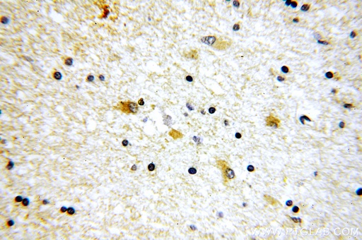 [14624-1-AP-20UL] SV2B Polyclonal antibody