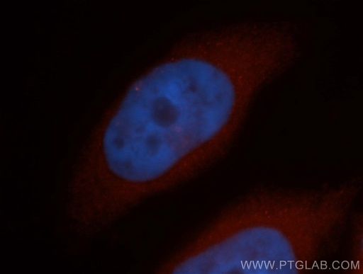 [14625-1-AP-20UL] RABEP2 Polyclonal antibody