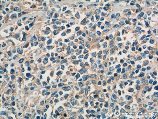 [14626-1-AP-20UL] SHARPIN Polyclonal antibody