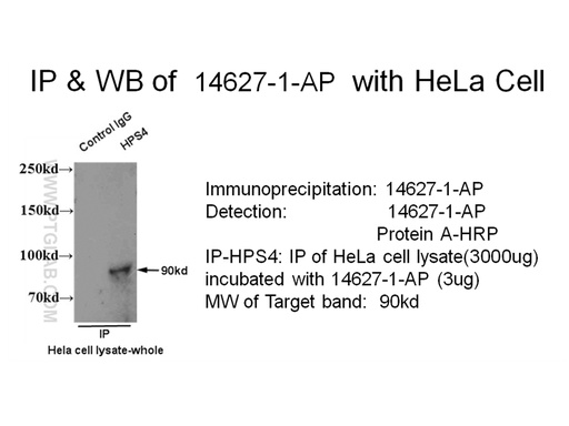 [14627-1-AP-150UL] HPS4 Polyclonal antibody