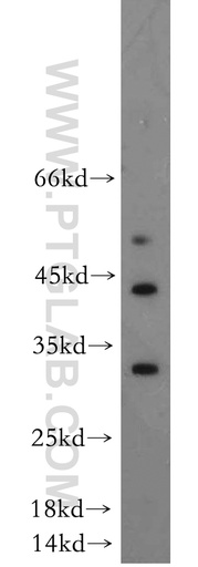 [14629-1-AP-150UL] DUSP15 Polyclonal antibody