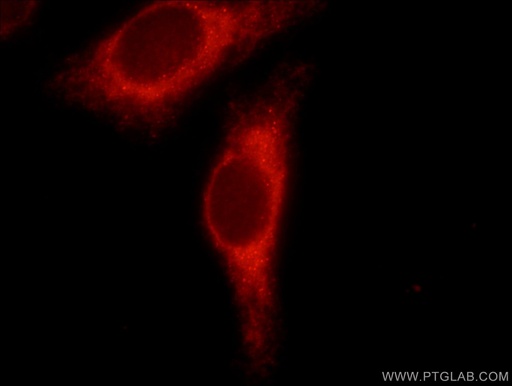 [14634-1-AP-20UL] PPP1R15B Polyclonal antibody