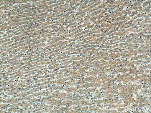 [14636-1-AP-20UL] SRPRB Polyclonal antibody