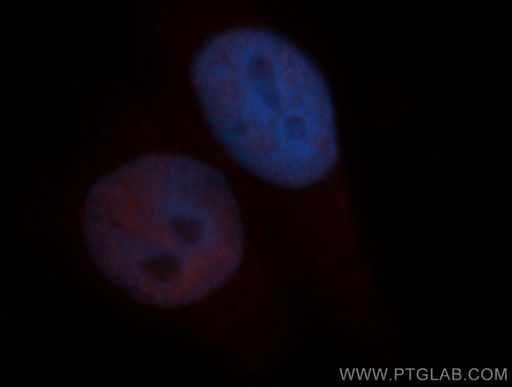 [14638-1-AP-150UL] SIN3A Polyclonal antibody