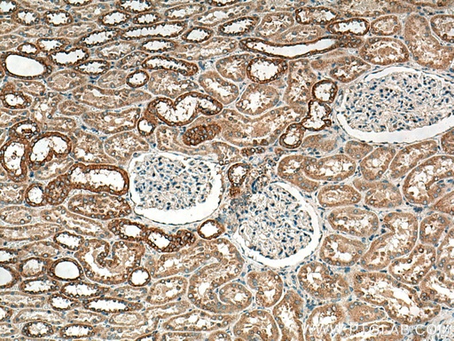 [14639-1-AP-150UL] CHMP1B Polyclonal antibody