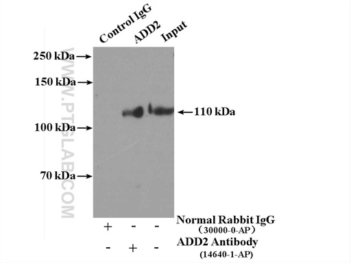 [14640-1-AP-20UL] Beta Adducin Polyclonal antibody