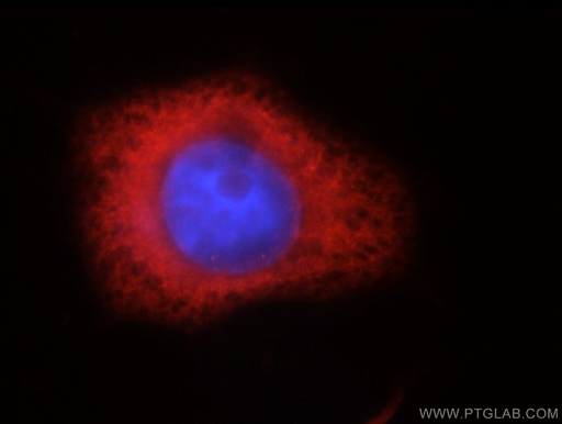 [14642-1-AP-20UL] IGF2BP3 Polyclonal antibody